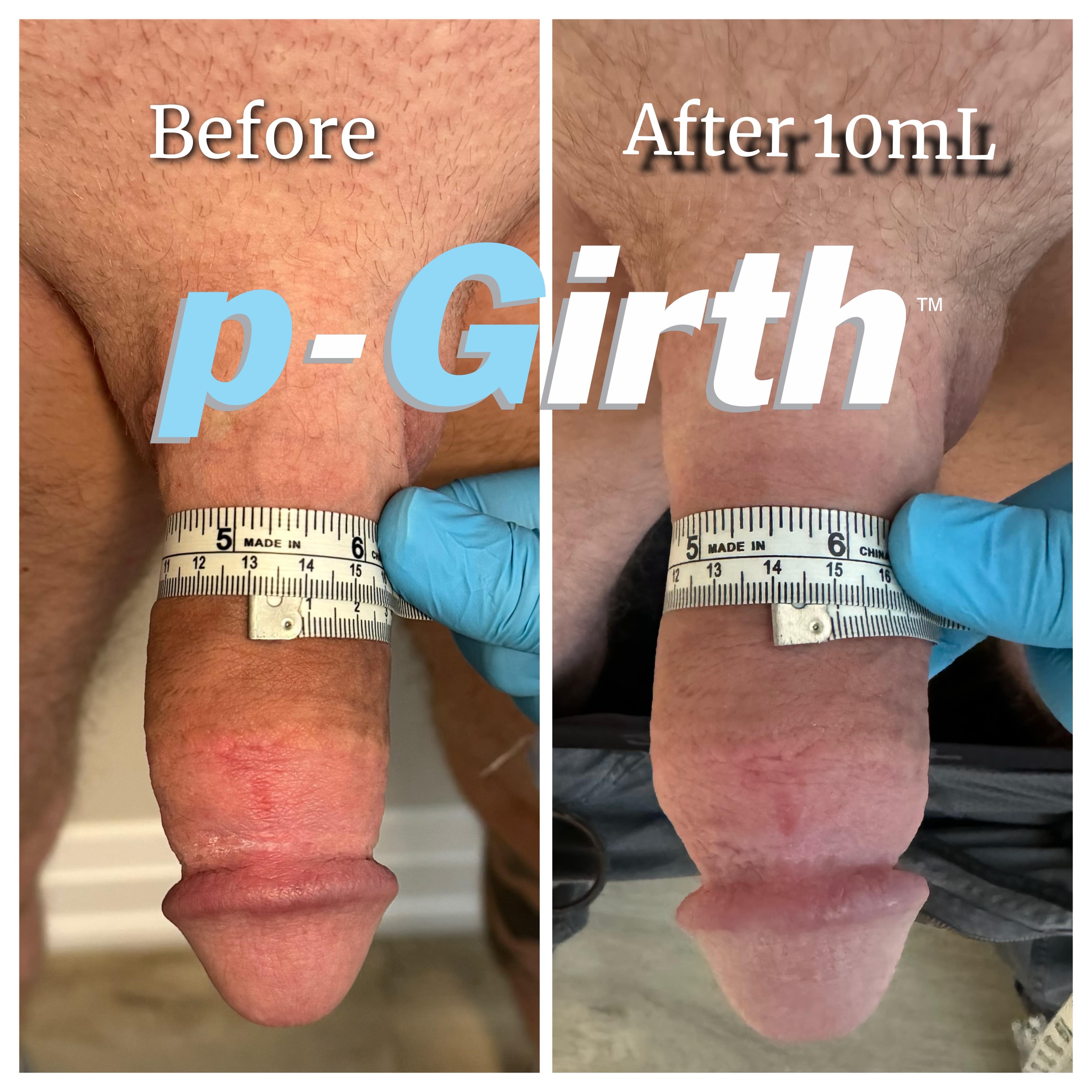 10mL3 min