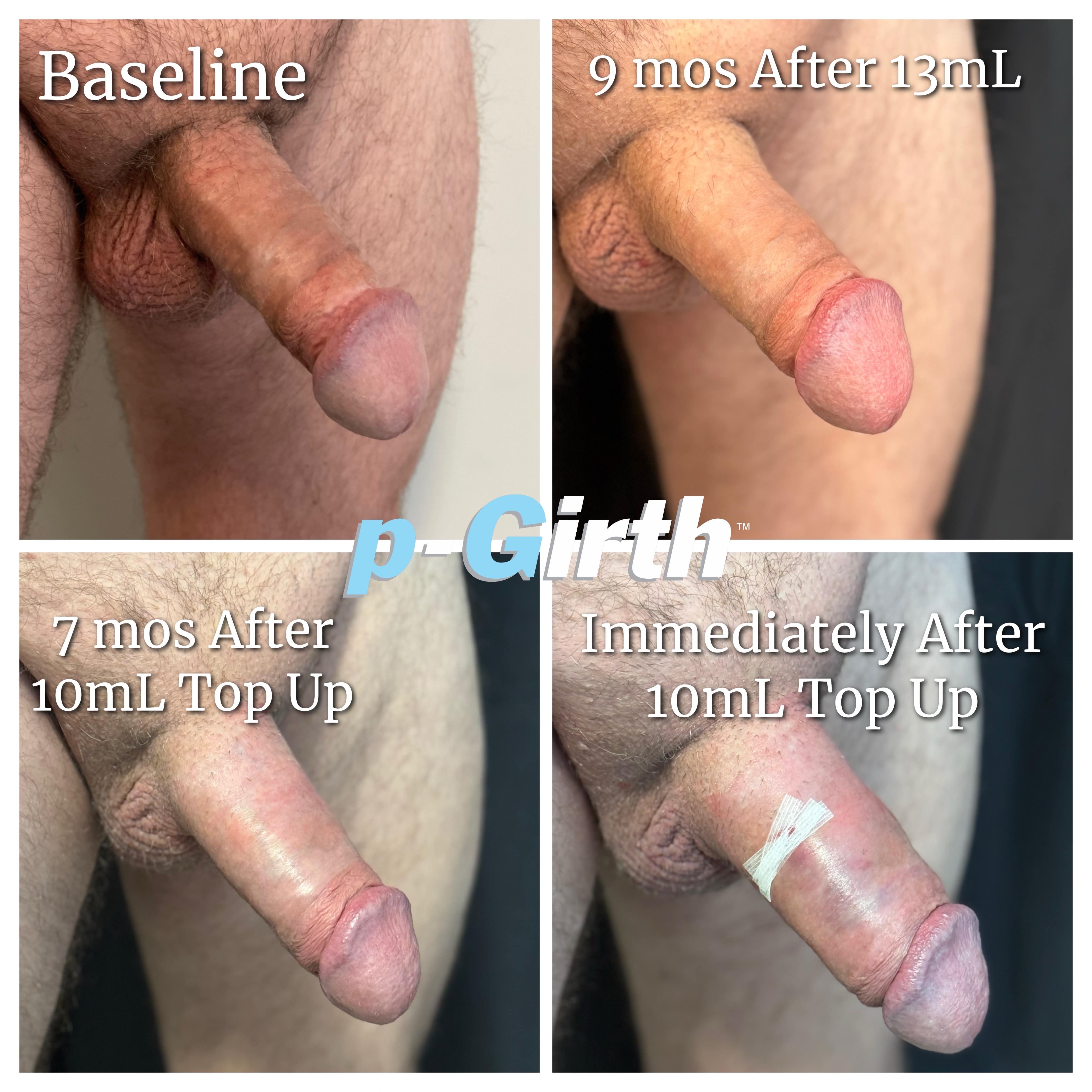 2025 13mL1c min