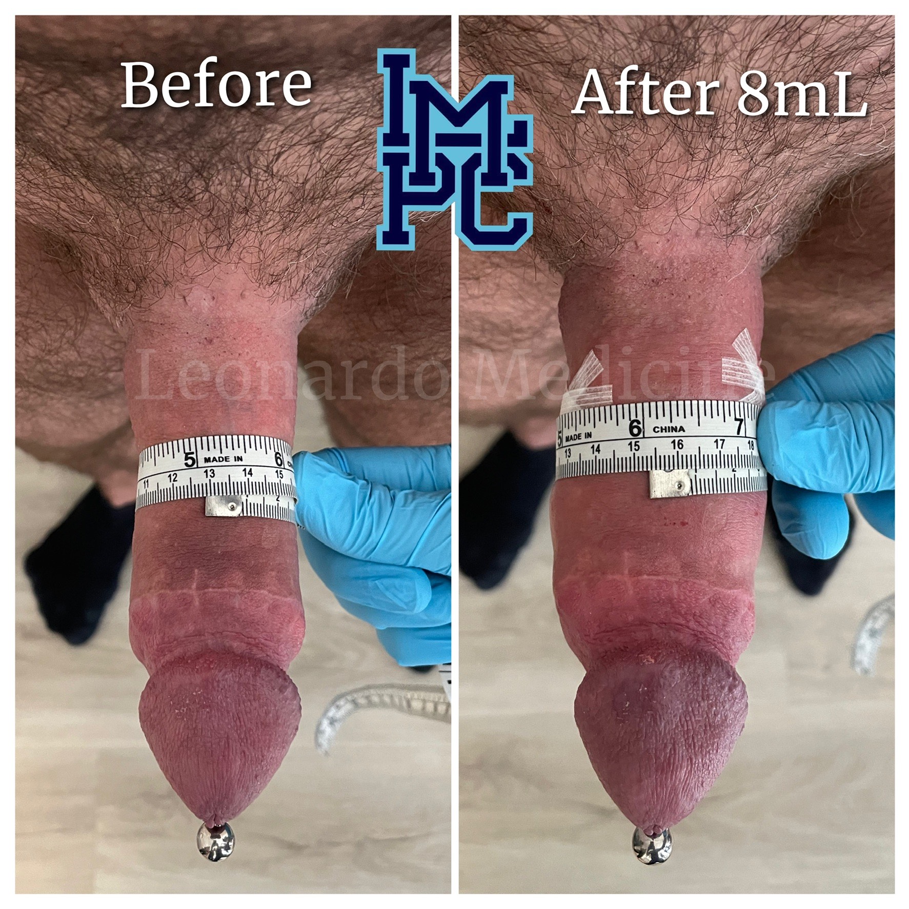 8mL3