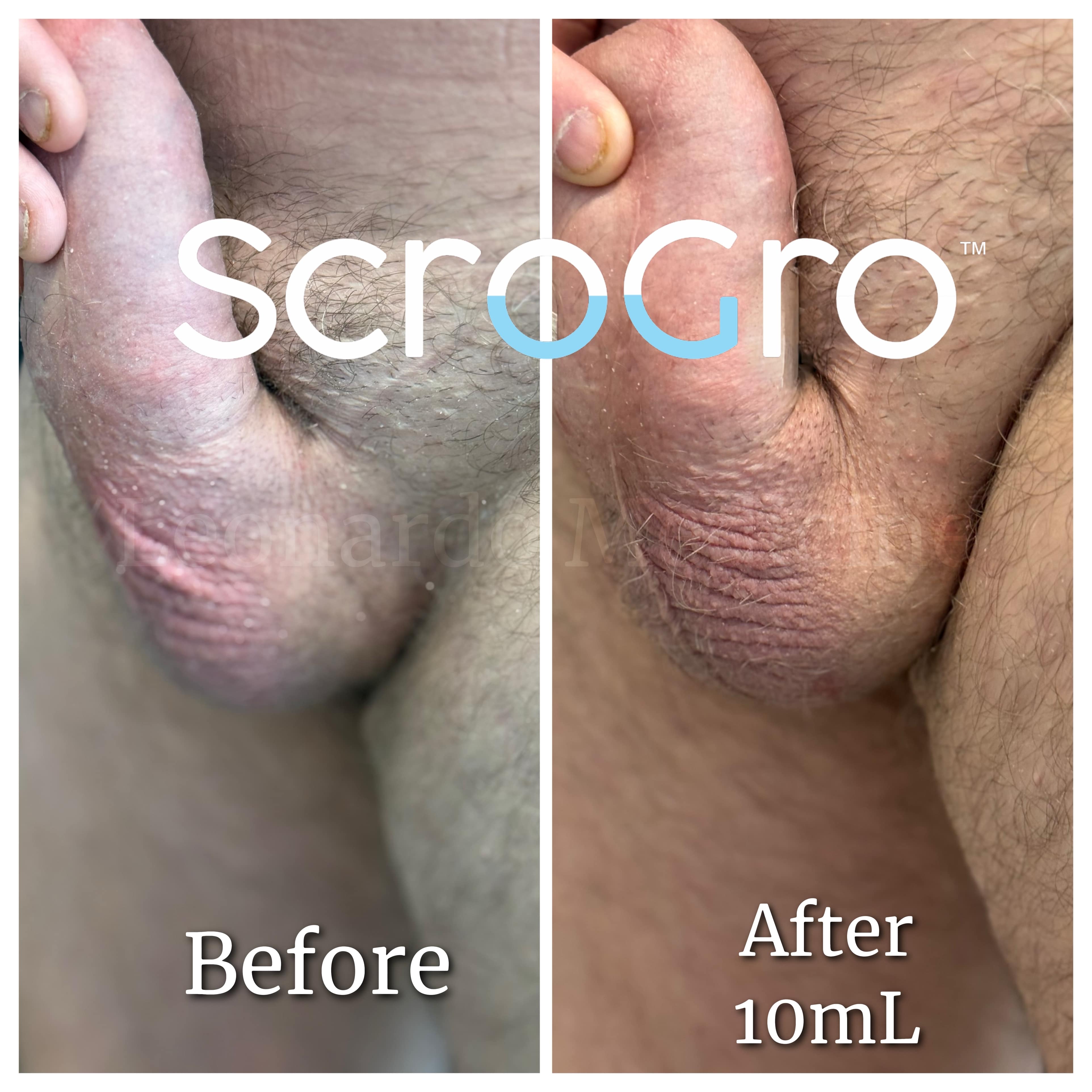 nov2025leogrowcox5